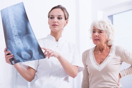 X-ışını muayenesi, omurganın osteokondrozunu teşhis etmenin bilgilendirici bir yoludur