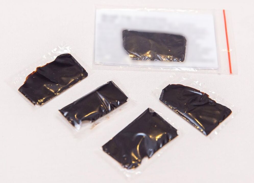 Shilajit, evde servikal osteokondrozun tedavisi için etkili bir ilaçtır